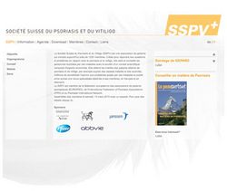 Psoriasis et vitiligo