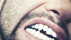 Facture de dentiste: savoir montrer les dents