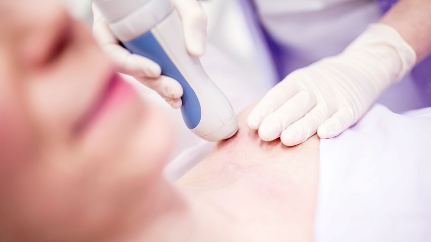 Prestation au laser remboursée par l’assurance maladie