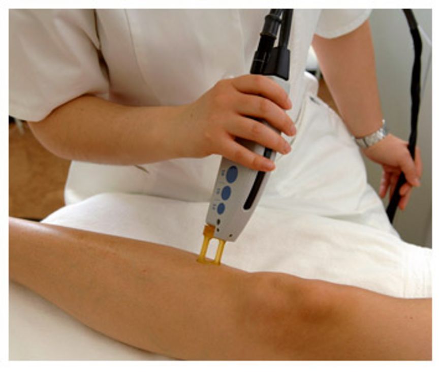 Epilation laser: sujet brûlant!
