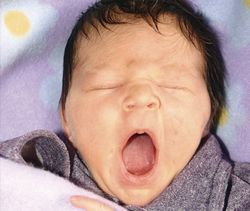 Maux de ventre,  bébé chevelu?